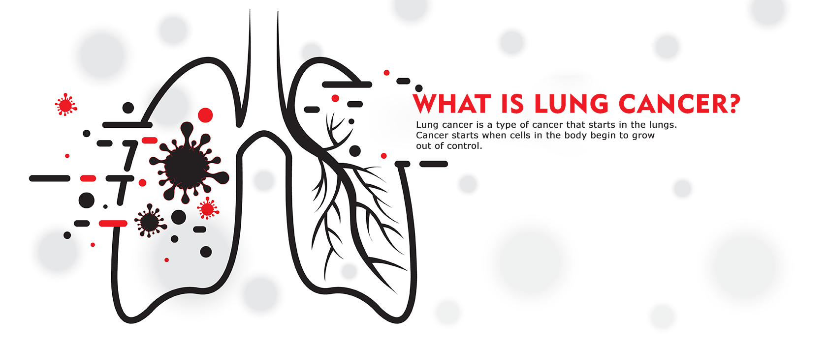 Illustration of human lungs with cancer cells spreading, showing how lung cancer develops through uncontrolled cell growth.