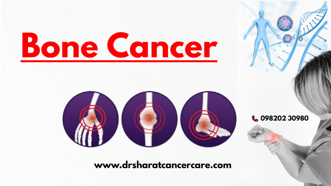 Bone Cancer Image 1280x720
